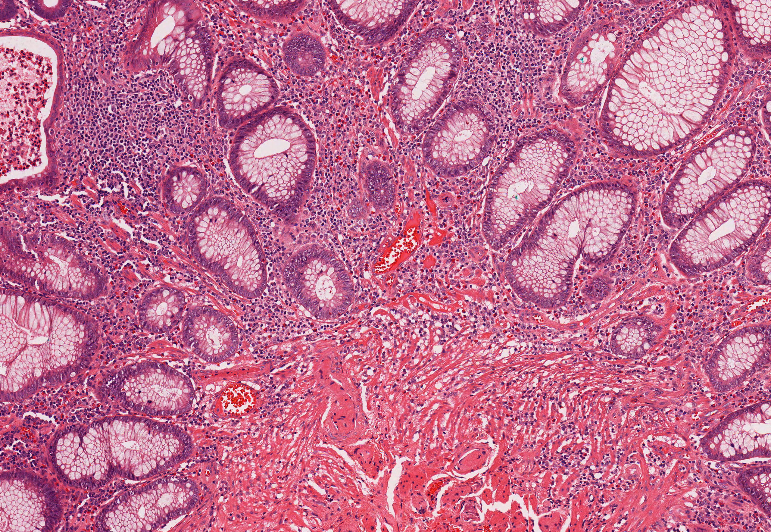 gut-brain connection