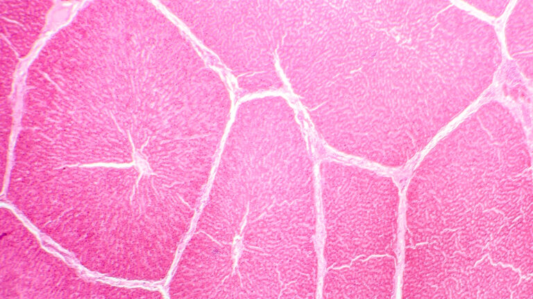 cholesterol, Digestion, Nutrition