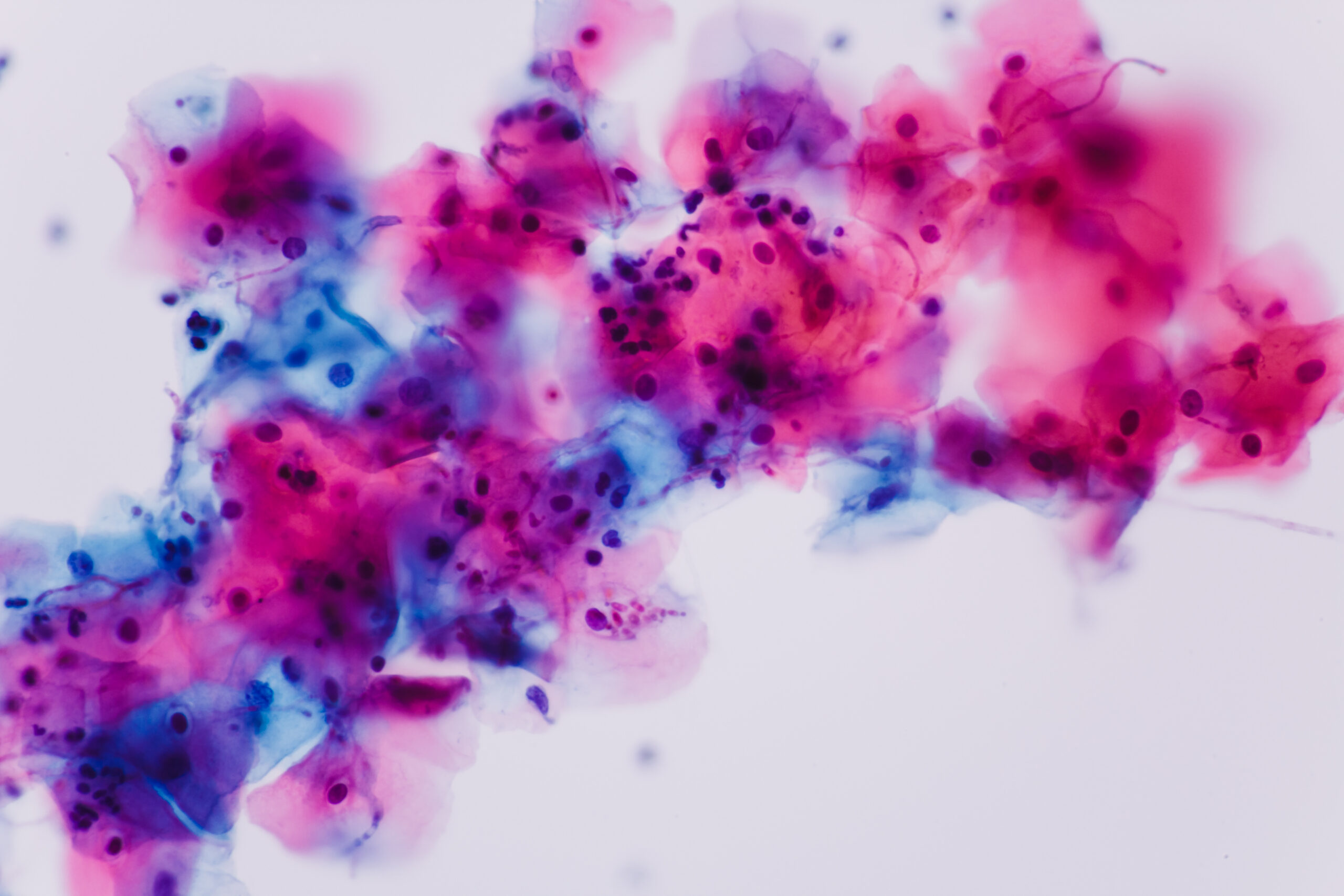 Functional Nutrition Tool: Candida Questionnaire | Functional Nutrition Lab