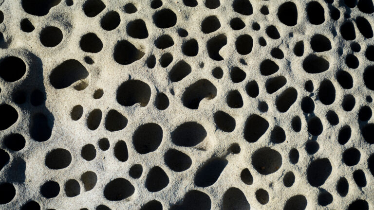 fxna degenerative holes